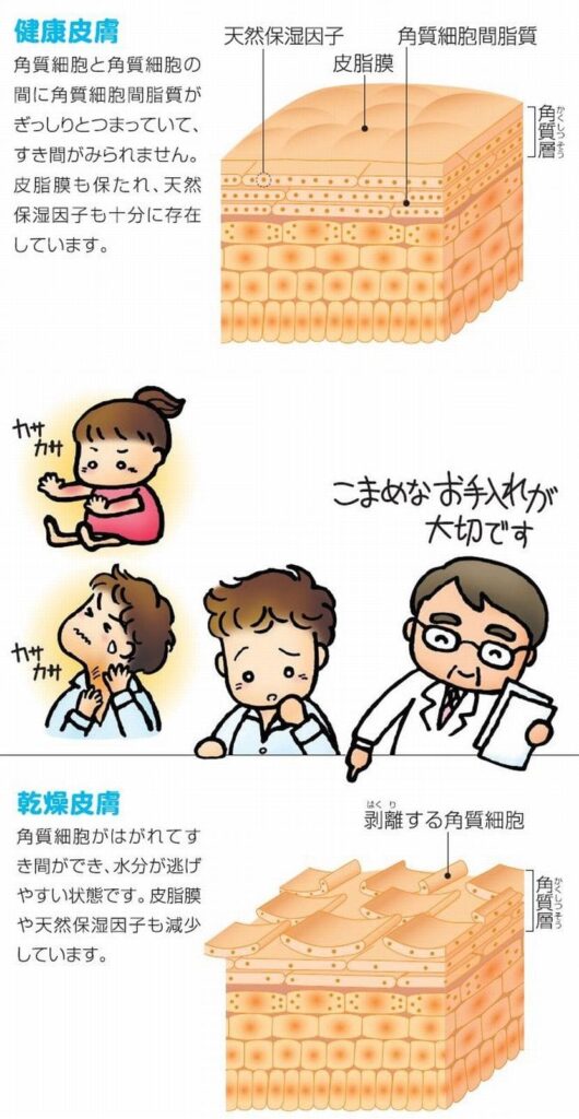 健康皮膚と乾燥皮膚について