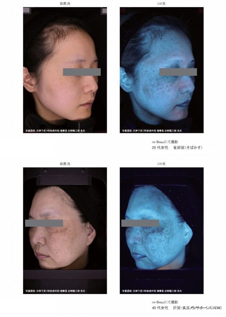 Re-Beau2参考資料
